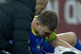 fenerbahceye-edin-dzekodan-kotu-haber-kirik-suphesi-var-6Xf2TxWD.jpg