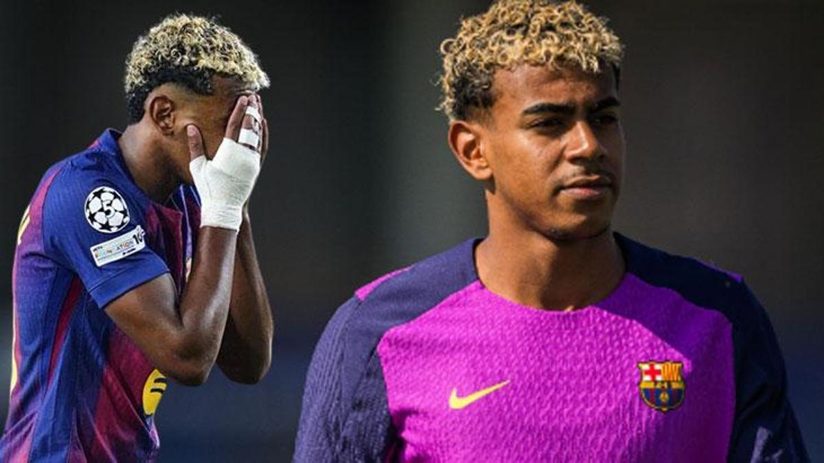 lamine-yamal-sakatlandi-barcelonaya-psg-maci-pahaliya-patladi-1zCh99WE.jpg
